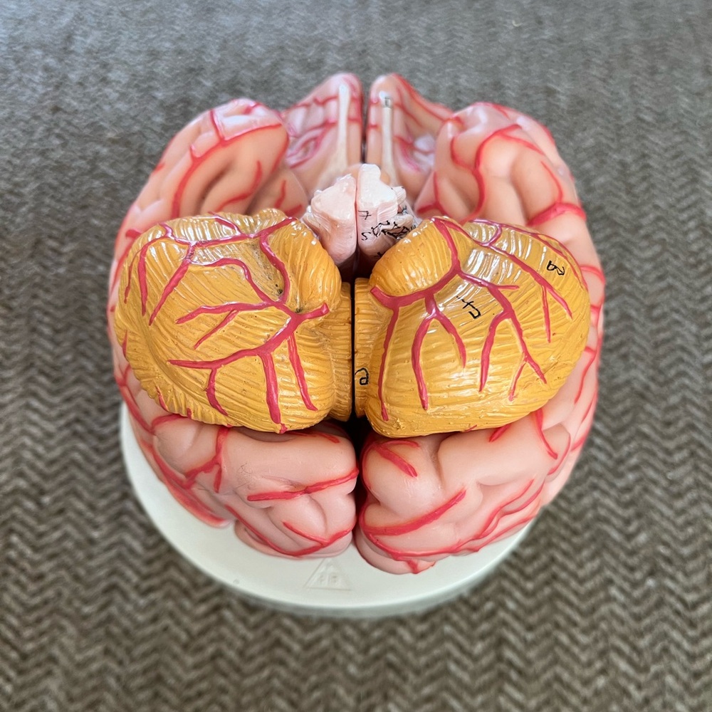 Vintage Model of Human Brain - Picture 2 of 6